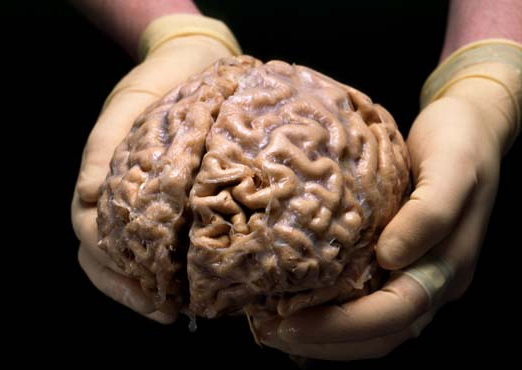 brain-in-hands brain in hands